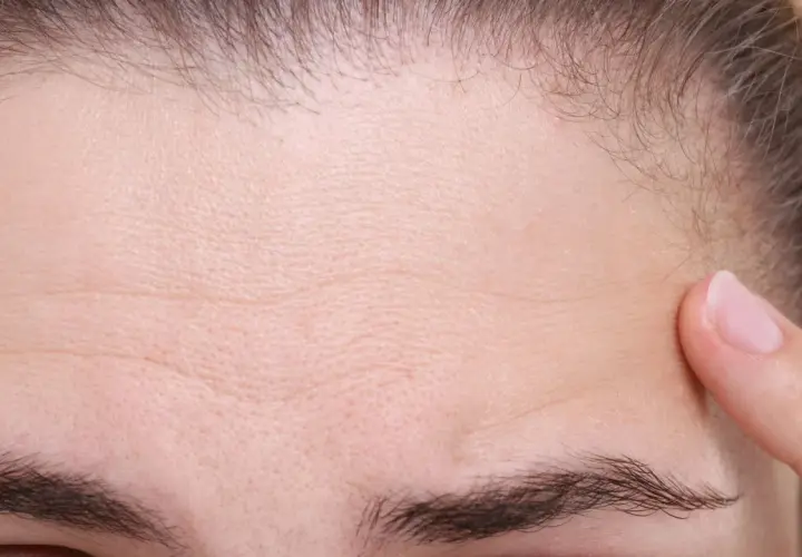 Primer plano de una frente con arrugas finas y una ceja poblada, casi una uniceja. Un dedo toca suavemente la piel.