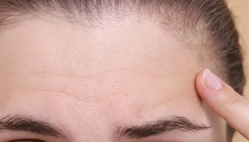 Primer plano de una frente con arrugas finas y una ceja poblada, casi una uniceja. Un dedo toca suavemente la piel.