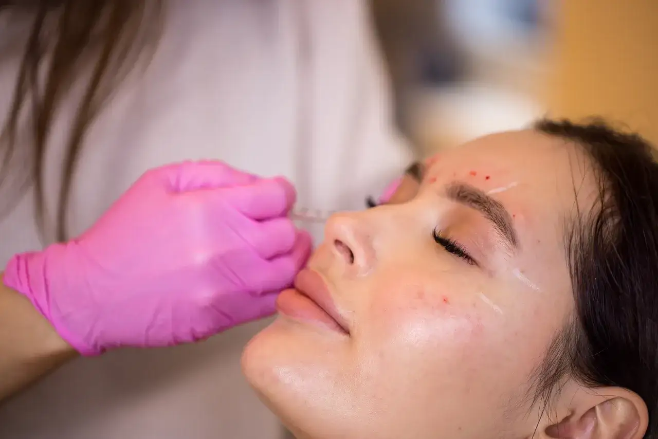 Una mano enguantada en rosa administra un tratamiento facial con exosomas, marcando puntos en la piel para una aplicación precisa.